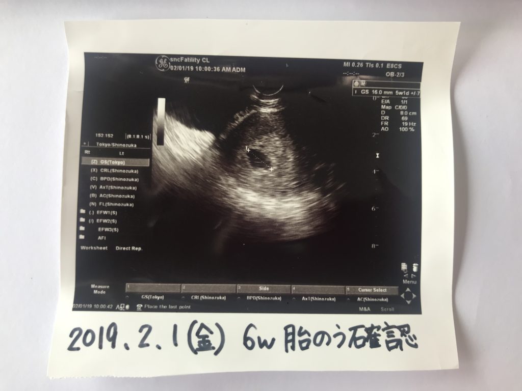 はじめての妊娠 胎嚢確認 妊娠６週目 多嚢胞性卵巣のワタシの妊活ブログ